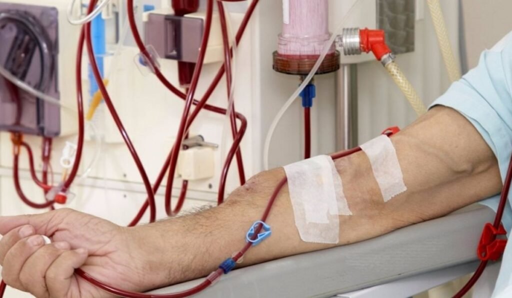 MT Default Temp 35 1