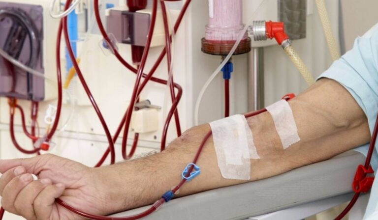 Free Dialysis Program Widens Access in Four Punjab Districts