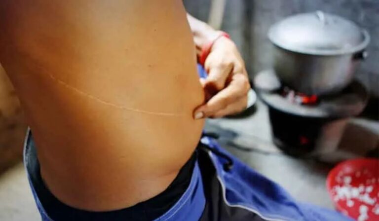 Lawmakers Slam Agencies as Organ Trafficking Scandal Unfolds