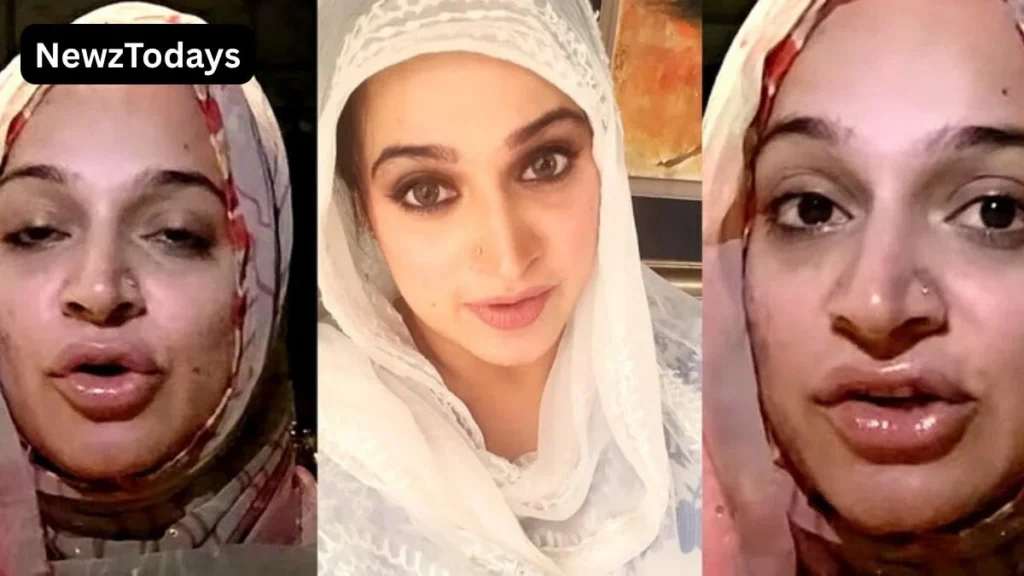 Noor Bukhari Faces Backlash Over Lip Fillers