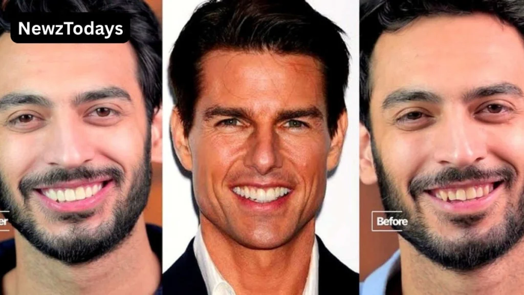 Saif Ali Khan's Hollywood Smile Draws Mixed Reactions